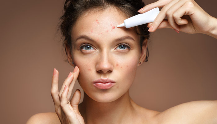 Acne-Prone Skin? Here’s How to Identify and Create the Right Routine